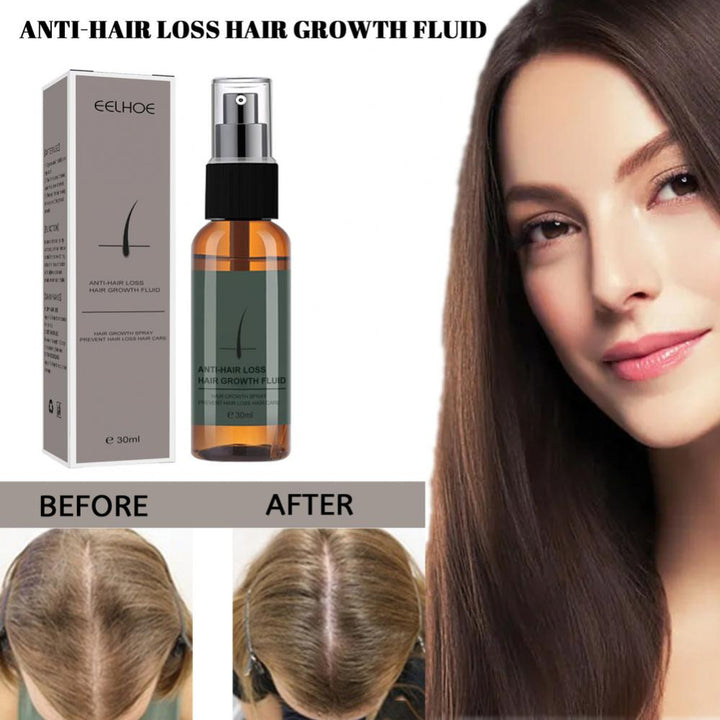 Produtos para o crescimento do cabelo Spray de gengibre nutritivo para o recrescimento