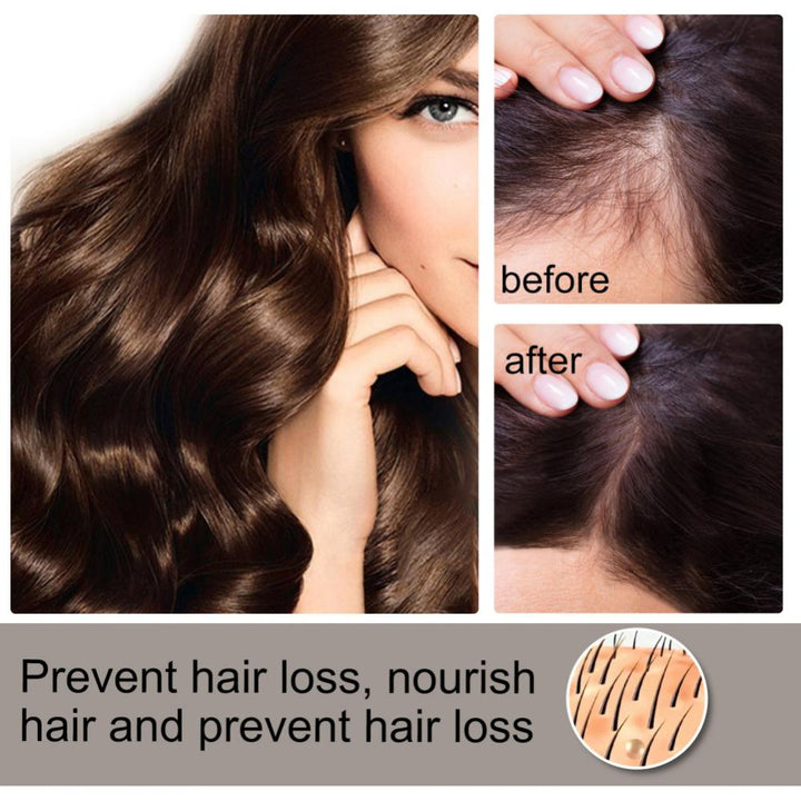 Produtos para o crescimento do cabelo Spray de gengibre nutritivo para o recrescimento