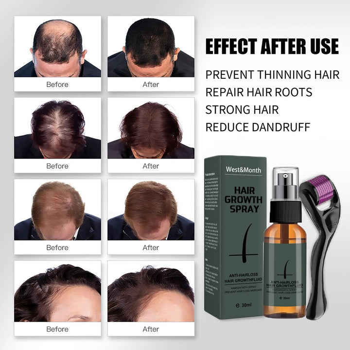 30ml Hair Beard Growth Roller Set Beard Oil Spray