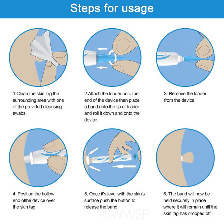 2 IN 1 Auto Skin Tag Remover Kit Micro Skin Tag Removal Device
