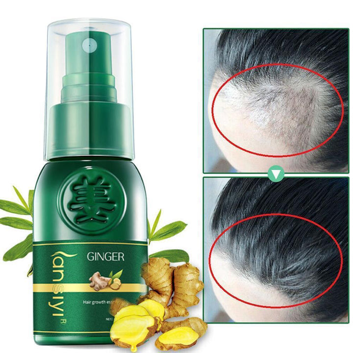 Óleo Essencial de Gengibre para Crescimento Rápido do Cabelo 30ml Tratamento para Queda de Cabelo