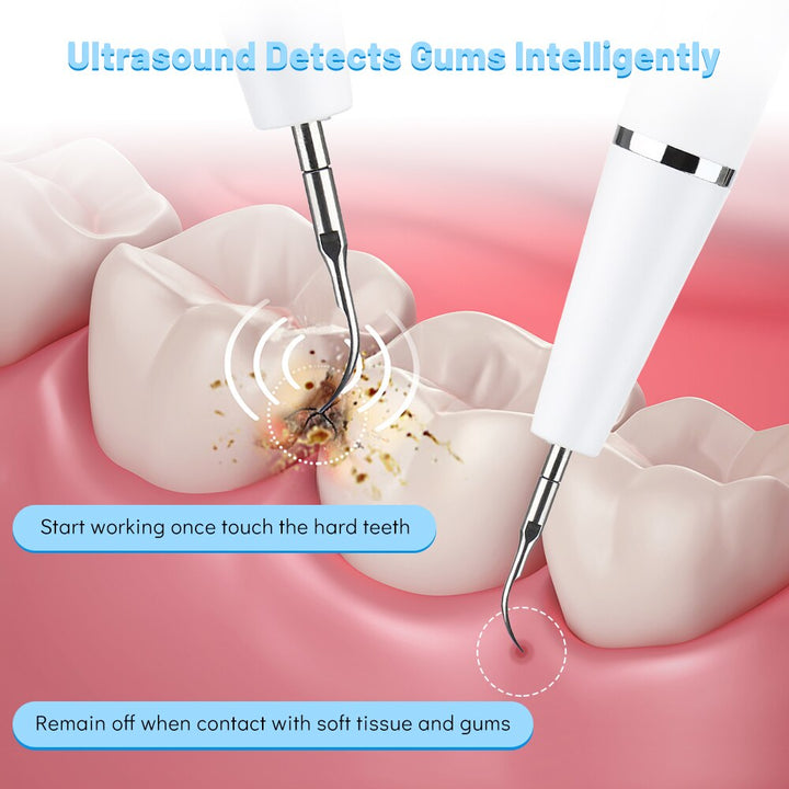 Removedor de Tártaro Ultrassónico Doméstico Descalcificador Dentário Elétrico Portátil