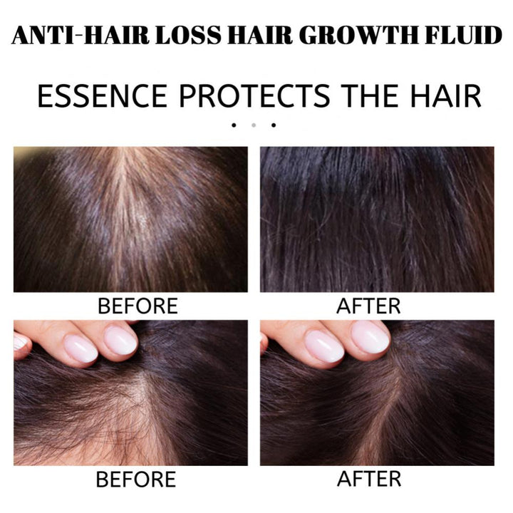 Produtos para o crescimento do cabelo Spray de gengibre nutritivo para o recrescimento
