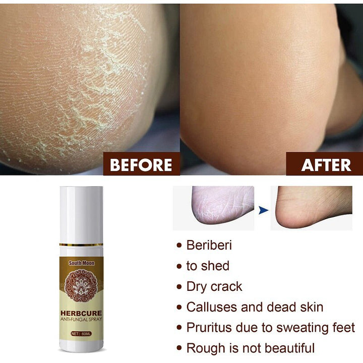60ml Fungal Combat Feet Spray Foot Sterilize Spray