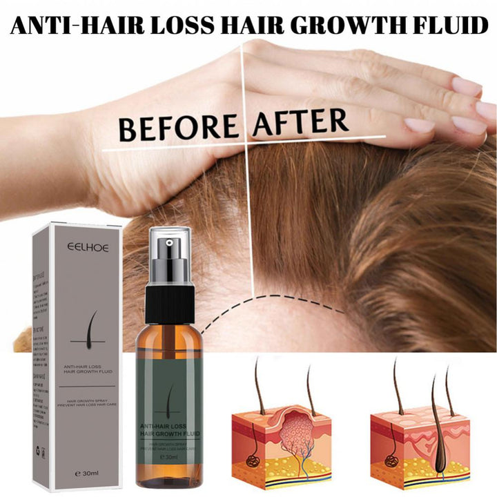 Produtos para o crescimento do cabelo Spray de gengibre nutritivo para o recrescimento